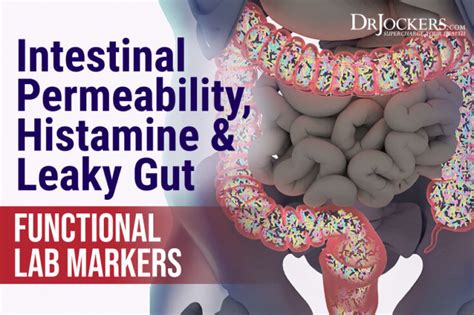 what is intestinal permeability test|intestinal permeability test kit.